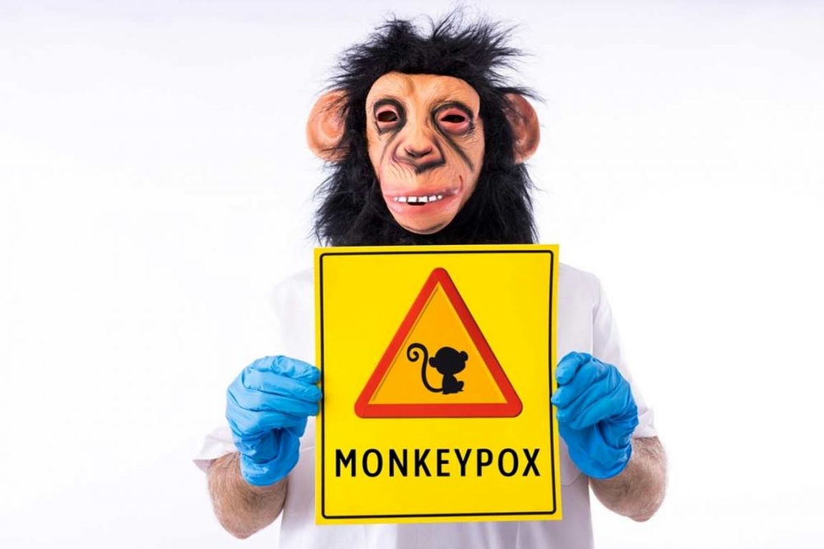 آبله میمونی وضعیت اضطراری بهداشت جهانی اعلام شد