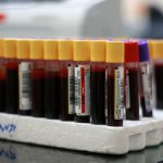 ذخیره فرآورده های خونی در ایران چقدر است؟