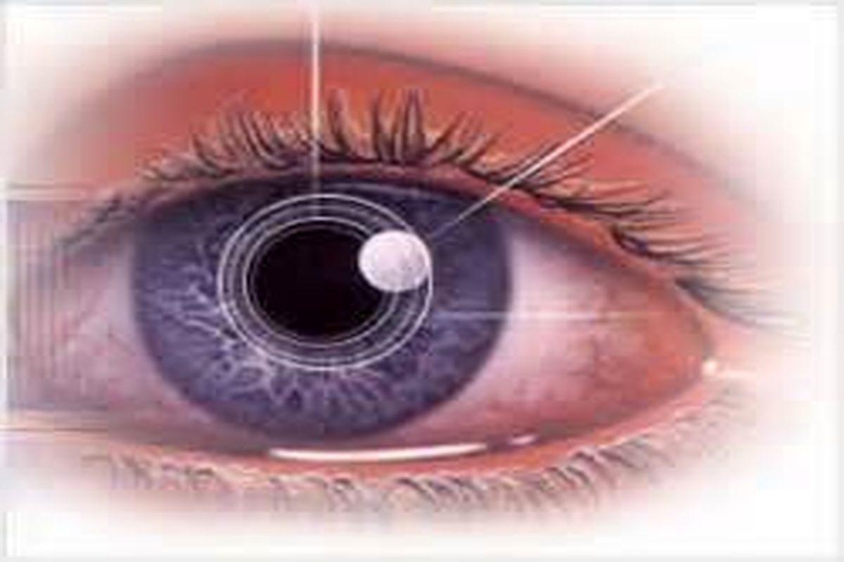 برگزاری کنگره انجمن چشم پزشکان ایران در اواخر خرداد ماه/ مشکل واردات تجهیزات چشم پزشکی گمرک است